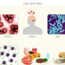 갑자기 물설사 원인 계속 나올 때 물설사 멈추는법 이미지