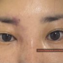 논현로 1L 이미지