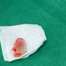 서울미소플란트치과의원 이미지