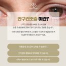 영등포안구건조증안과 안구건조증 증상, 치료방법 [밝은빛 성모안과]