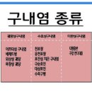 입병 원인, 아프타성 궤양성 구내염 빨리 낫는법 (입술 안쪽 물집 수포, 혓바닥, 잇몸, 구강궤양, 가글, 전염) 이미지