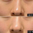 심해 | 악건성 보습크림 속건조 심해져서 올리브영 (+득템후기)