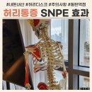 솔고건강센터중앙지점 | SNPE 운동 허리디스크 환자 내돈내산 후기 &amp; 주의사항 (feat. SNPE 동탄역점)