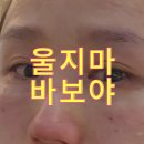 아이스킨 | 내돈내산 수면 리쥬란HB + 리쥬란아이 + 스킨보톡스 솔직한후기