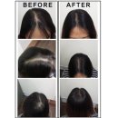 두피킹 - 수성구 신매동 | 두피킹