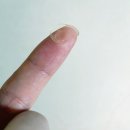 휴아이안과의원 | [영통안과추천]드림렌즈 2달 사용후기 체험후기 어린이 드림렌즈 영통휴아이안과 운동하시는분들 강력추천!