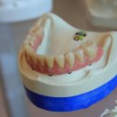 서울선(SUN)치과병원 | 우리 동네 치과 수다방: 30대 후반 언니가 알려주는 궁금증 백서