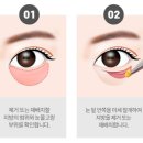 꼼꼼성형외과의원 이미지