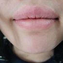 호만빌딩앞 | 세종시 어진동 피부과 전문 병원 좋아요 추천 List 6곳