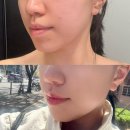 셀앤비에스테틱강남지점 | 선릉피부관리 [셀앤비 에스테틱] :: 얼굴 전체 피지, 필링관리후기