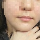르에이치의원 이미지