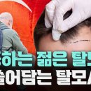 종로-연건-종로-연-343 | [지식343] 급변하는 탈모 시장, 19조가 움직인다