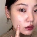 밸류메디컬 | 여드름 트러블 피부 두꺼운 파운데이션 대신 유산균 재생비비 파이널밤으로 완벽 커버 + 진정까지