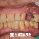삼송서울치과의원 이미지
