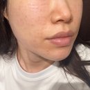 대세 | 요즘 대세 엘라비에 리투오 후기 2주차 모공 피부 밀도 변화