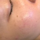 감삼동313 | 대구피부관리 감삼동 메이크뷰티스튜디오에서 콜드플라즈마 후기