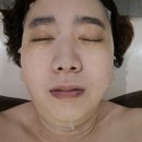 청담피부관리샾 | 압구정피부관리 이코르 청담-피부관리 후기✨