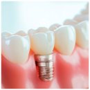 아로치과의원 | 원평동치과? 과잉진료를 피하는 핵심 2가지