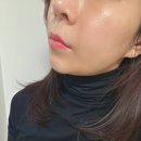 첨단환경 | 광주 첨단 피부과 리투오보다 더 촉촉한 스킨부스터 셀르디엠 내돈내산 후기