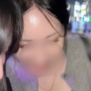 4 | 부산 연제구 피부과 이마필러 후기 뉴라미스 4cc + 몰딩 까지 일주일 솔직후기