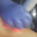 웰뷰파크 | 수원에스테틱 웰뷰티힐러에서 복부관리 후기