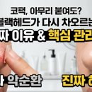 모공 수축 팩을 아무리 붙여도 다음 날이면 다시 거뭇하게 차오르는 진짜 원인
