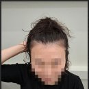 현암로89번길 | 용인탈모 두피관리 걱정없이 자신감 채우기