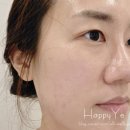 마담포라 | 강남 신부관리 세스티끄 윤곽관리 경락 후기