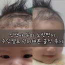 우리관리 - 안양시 동안구 학의로 282 | 신생아 두피 노란딱지, 스칼프 제품보다 수딩젤이 효과 있었던 우리 아기 관리 후기