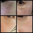 리젠셀의원 | 전라북도 정읍시 피부과 전문 병원 List 추천 3곳