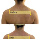 우리은행 마린시티지점 앞 | 해운대 마린시티승모근 관리 잘하는 미엘르 에스테틱