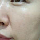 더마리턴5