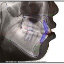 바로이치과의원 이미지