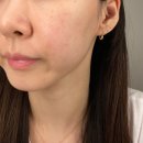 30대앰플 GS홈쇼핑 시카 식물성엑소좀 광채 50 앰플 실제 사용해본 후기
