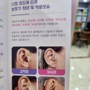 스타키보청기 용인난청센터 네이버블로그