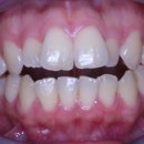 서울고운미소치과교정과치과의원 이미지