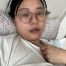 안양천로(목5동 이대목동병원) | 난자채취 후 복수, 수면마취 하 16개 채취 완료 (이대목동병원 시험관)