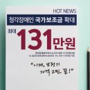 백세보청기 이미지