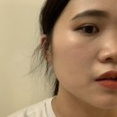 예쁠래에스테틱 | 광주 피부관리 뷰티리뷰 재방문후기 [ 예쁠래에스테틱 ] : 세멘시트부스팅관리