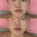 신도림웨딩케어 '에이치앤뷰티' 3D입체윤곽관리 후기