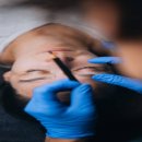 리프톤피부과의원 이미지