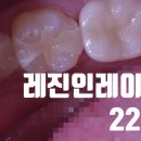 네이치과기공소 이미지