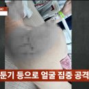 사건반장에 보도된 유튜버 수탉 피해 상태 이미지