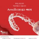 STL치과기공소 이미지