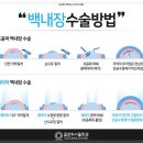 글로리서울안과의원 이미지