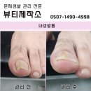 내성발톱 문제성발 전문샵 관리가 중요한 이유! #뷰티제작소 #시흥발톱무좀 #발각질 #발톱 이미지