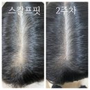 두피쉼터