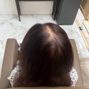 모모헤어(MoMohair) - 오산시 | 여자 정수리 탈모 원주미용실 모모 헤어클리닉 헤어증모술로!