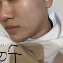 돈을 부르는 첫 걸음, 인스타그램 운영 초급 과정 | 미사여드름 문제성피부 전문 구띠끄 성인여드름·좁쌀 반복 개선 후기