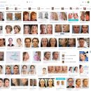 8콘(주) | 실루엣 소프트 -리프팅 실의 에르메스?